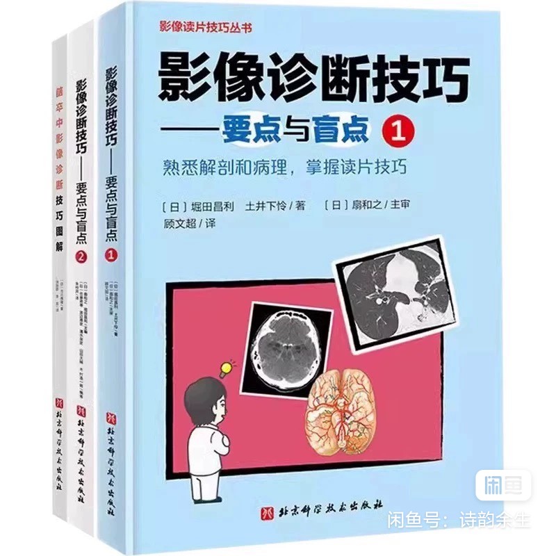 书籍推荐：脑卒中影像诊断技巧图解